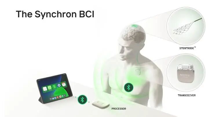 Synchron Debuts First Thought-Controlled iPad Experience | Medical Product Outsourcing